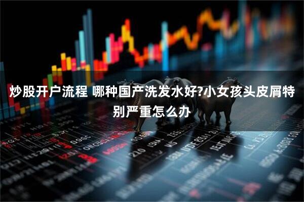 炒股开户流程 哪种国产洗发水好?小女孩头皮屑特别严重怎么办